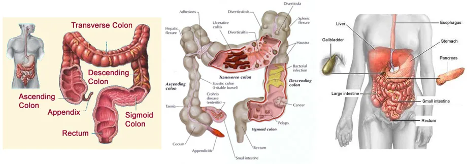 Colonic Machine Colon Cleansing 182