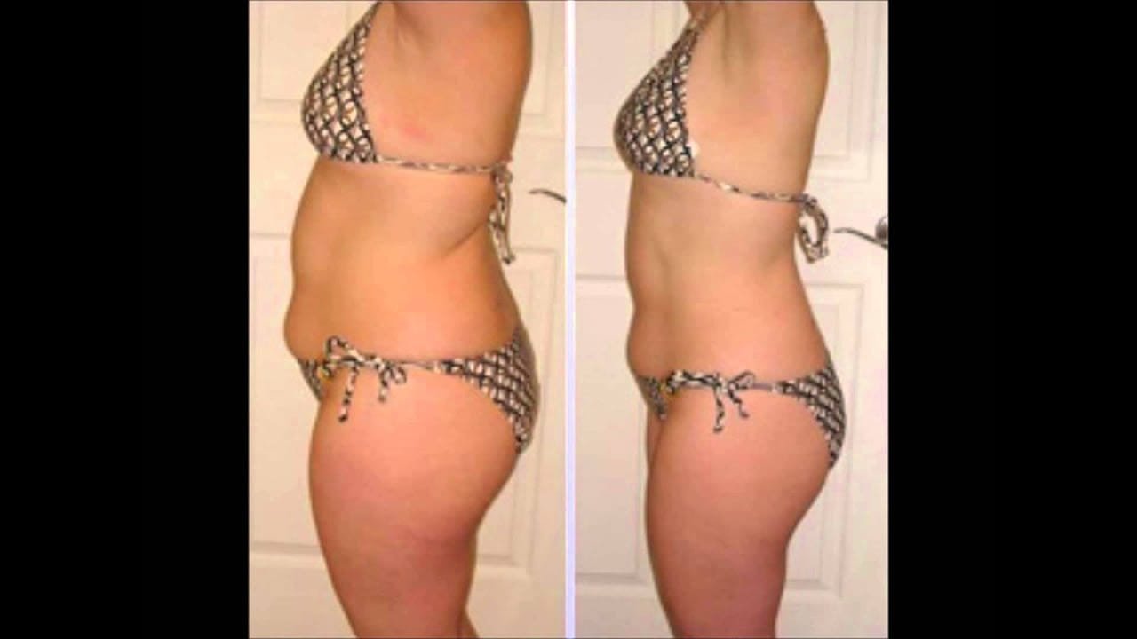 How Much Does a Colonic Cost? 1 Colon Cleansing Machine 256