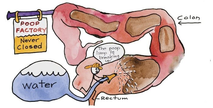 What Are the Benefits of a Cleanse? 2 Colon Cleansing Machine 265